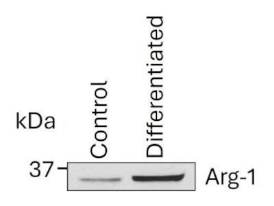 たにひろ様 THP 1ml Excellent Kit for Differentiating CD14+ THP-1 Cells into an M2